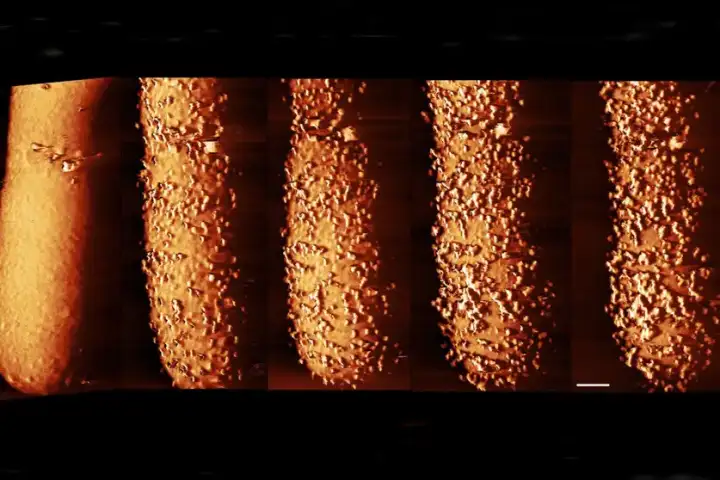 От антибиотика на бактерии вырастают странные наросты, а затем она разрушается.