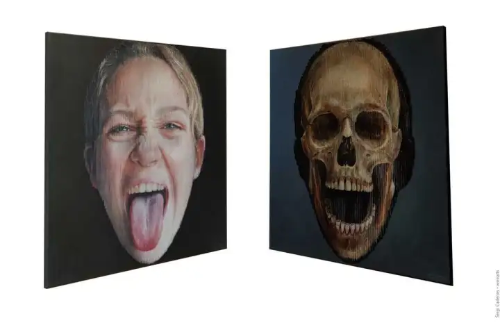 А также делается рентген.