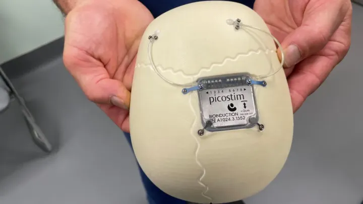 Устройство помещается прямо в череп.