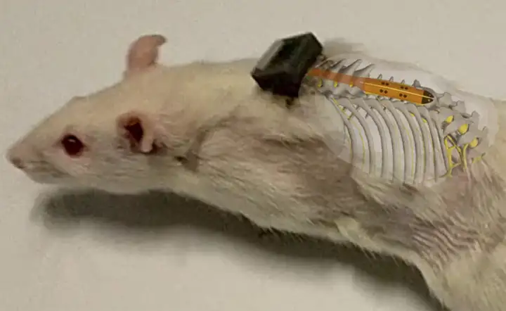 Визуализация имплантата спинного мозга.