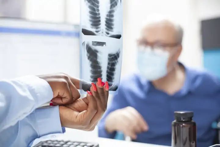 Понимание того, как потеря Y-хромосомы влияет на результаты лечения рака легких, может помочь в принятии решений о терапии.