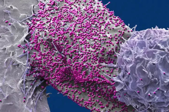 ВИЧ-инфицированная человеческая клетка.