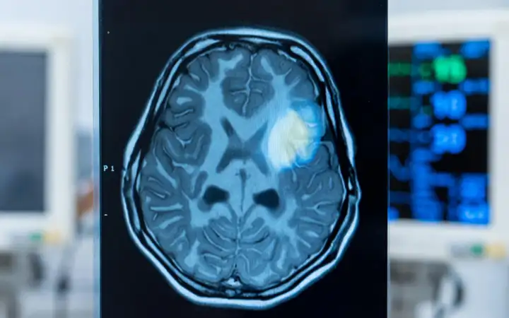 Скан мозга.