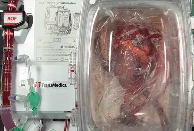 Именно благодаря маленькому мозгу сердце продолжает биться вне тела.