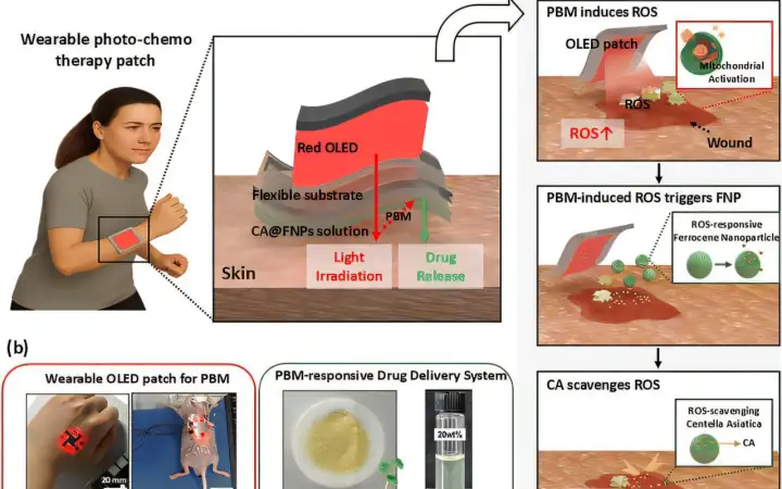 Схема комбинированного лечения светом и лекарственными препаратами с использованием OLED-пластыря.
