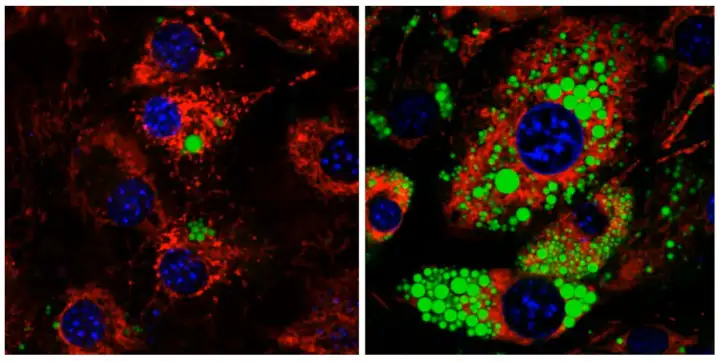 Жировые клетки, лишенные MTCH2 (слева), имеют меньше жировых капель (зелёные), чем обычные жировые клетки (справа)